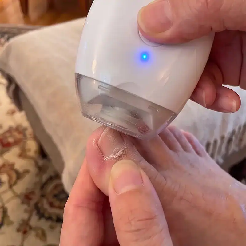 Placez la tête contre votre ongle